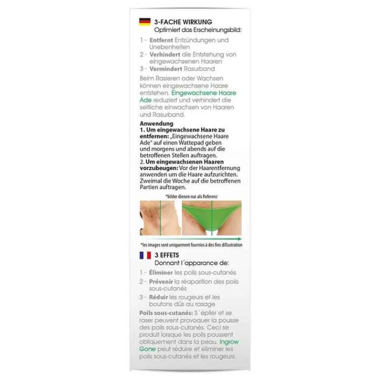 Biomed eingewachsene Haare ade Creme, 90 ml