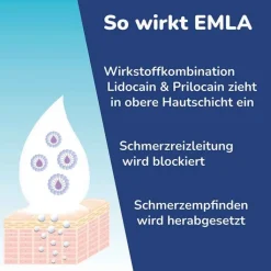Emla Creme + Tegaderm Pflaster, 5 g