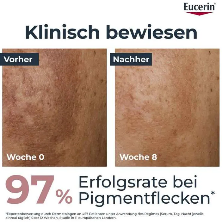 Eucerin Anti-Pigment Dual Serum - Pigmentflecken, 30 ml