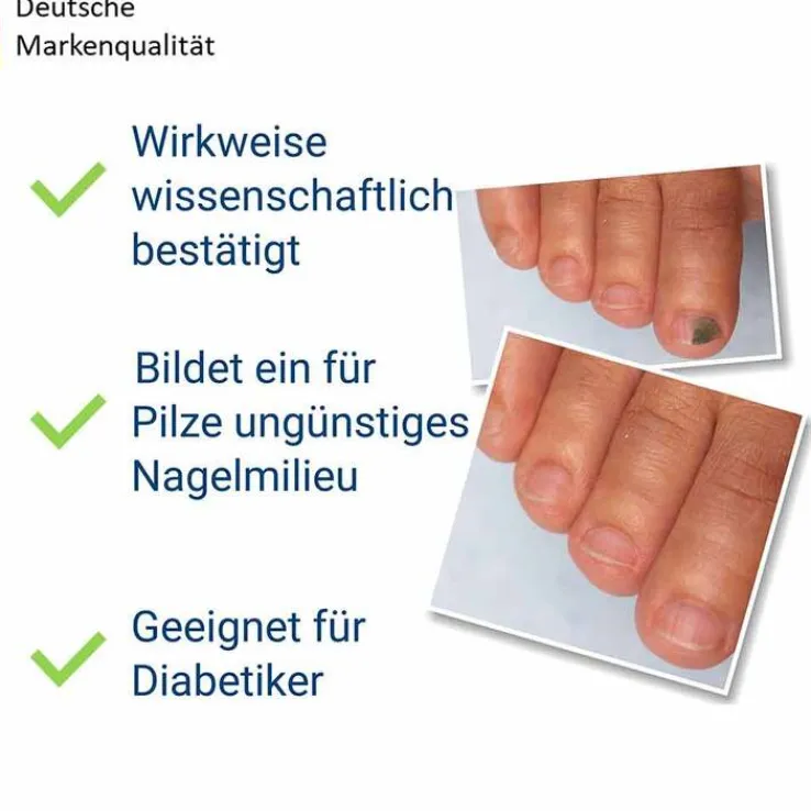 Evolsin Anti-Nagelpilz liquid, 10 ml