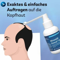 Minoxidil Dexcel 50 mg / ml Spray z.Anw.a.d.Kopfhaut, 3X60 ml